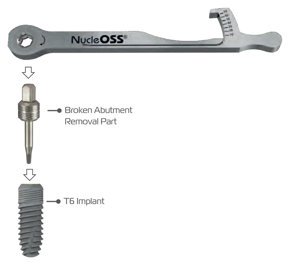 The broken abutment removal part and a T6 implant, with a torque ratchet