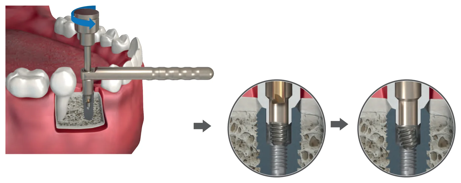 Method 1: turning the drill counterclockwise by hand, with details of the screw coming loose