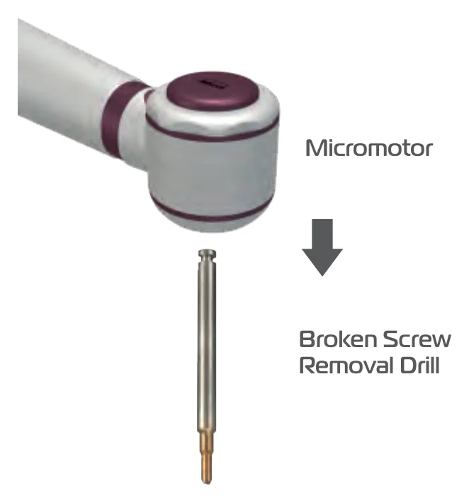 The micromotor and the broken screw removal drill