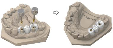 Model with two occlusal screws held above the bridge, then the bridge seated on the model after corrections.
