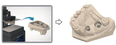 A 3D resin printer producing the dental model, then the printed dental model with the multi unit analogue positions.
