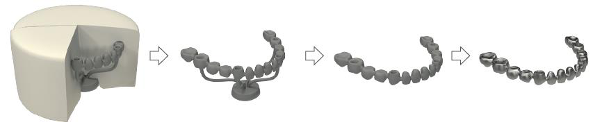 Casting sequence in four views: the investment block with the cast metal framework, the framework freed from the investment, the metal tooth model with the casting channels cut off, and the finished metal framework.