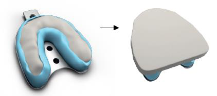 Impression tray holding blue impression material with an arrow to a grey plaster model with blue-tipped bases, showing the plaster model made from the impression