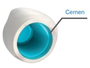 Close-up of a crown seen from below, its inner wall coated in blue cement, labelled “Cemen”