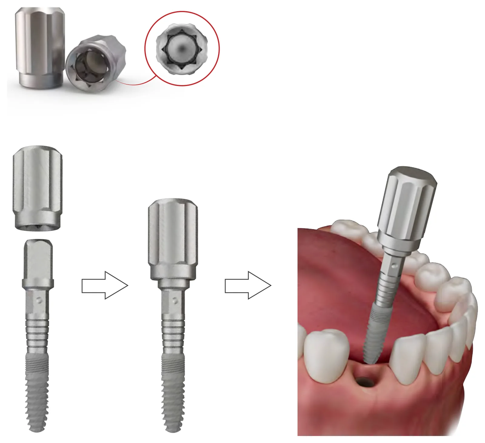 Ratchet manual adaptor T0 25218 with a detail of its internal profile, fitted to a component and used by hand in the mouth