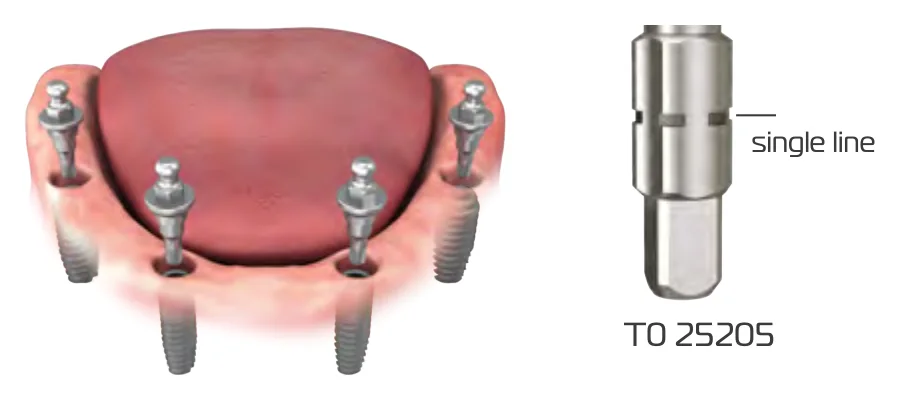 Ball abutment tightening part T0 25205, marked with a single line, and ball abutments on implants