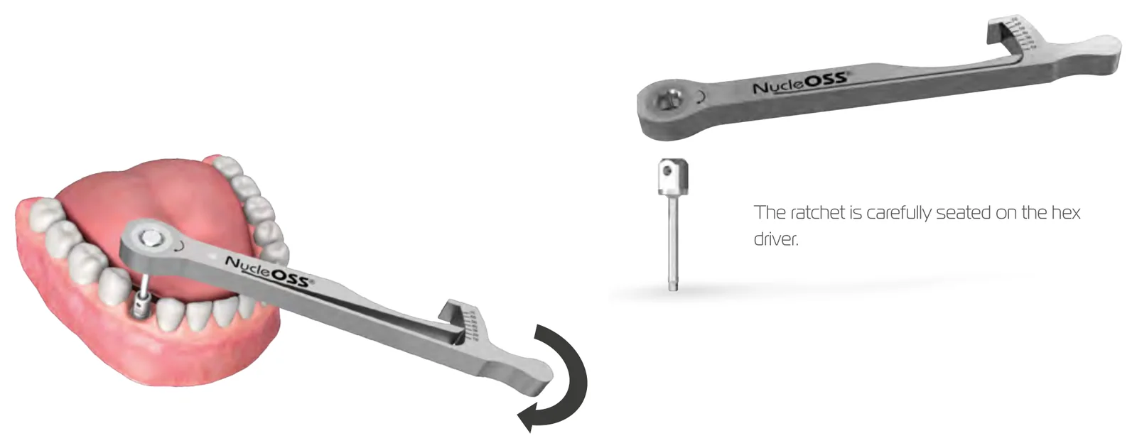 Seating the ratchet on the hex driver and turning it clockwise to tighten a screw in the mouth