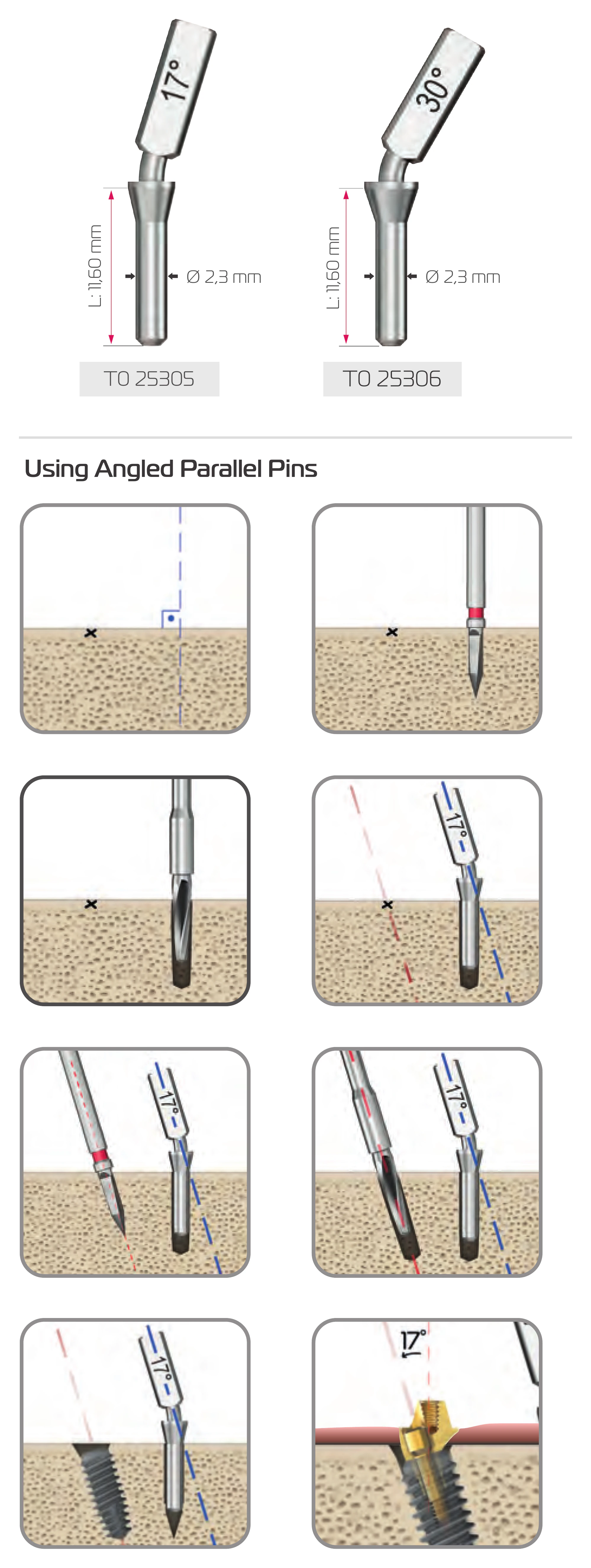 Angled pins T0 25305 at 17° and T0 25306 at 30°, L 11.60 mm, Ø 2.3 mm, and eight steps for using an angled pin to place an implant for an angled multi-unit abutment