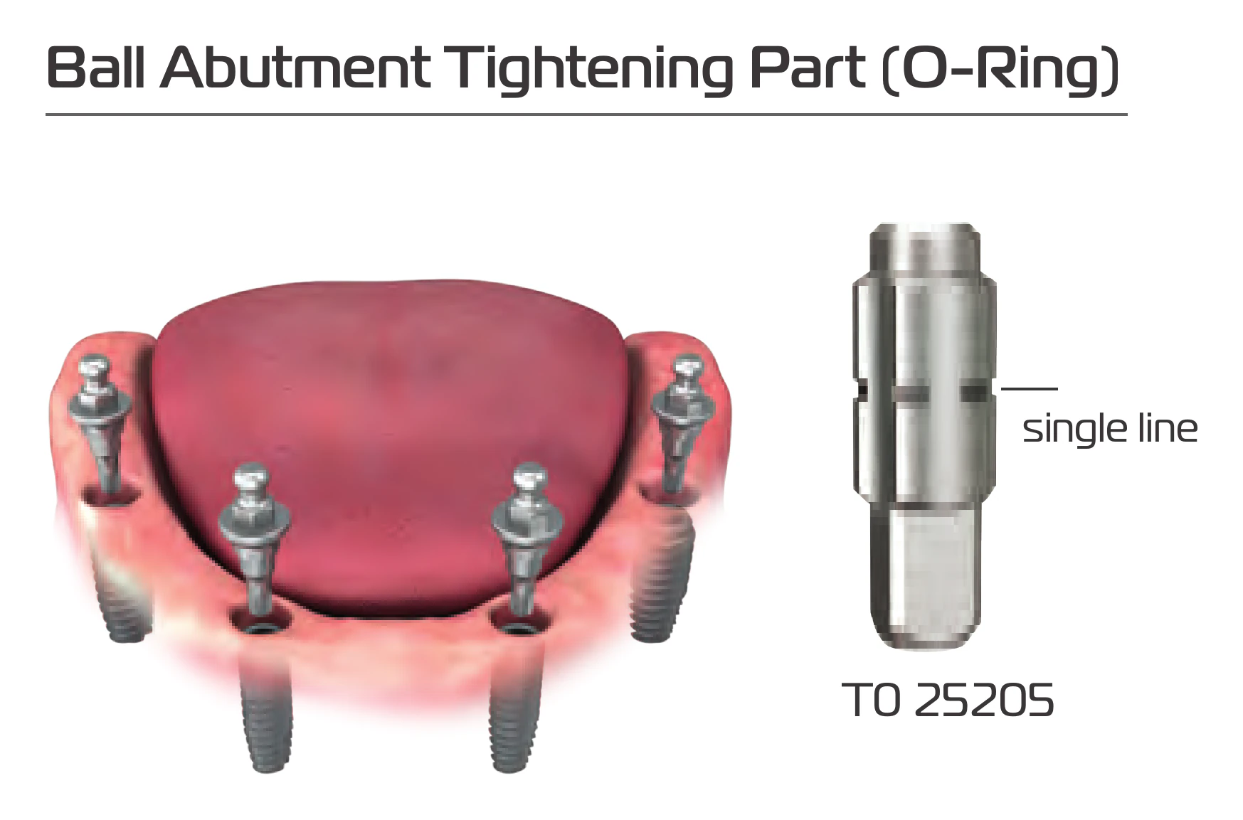 Ball abutment tightening part T0 25205 with its single line marking
