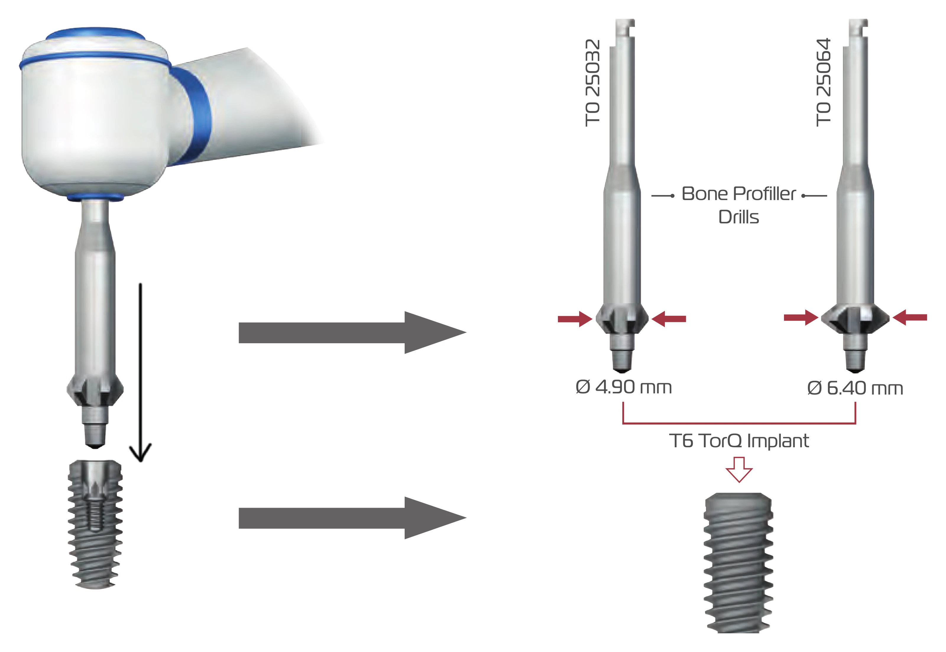 Bone profiler drills T0 25032 Ø 4.90 mm and T0 25064 Ø 6.40 mm used with a micromotor over the T6 TorQ implant