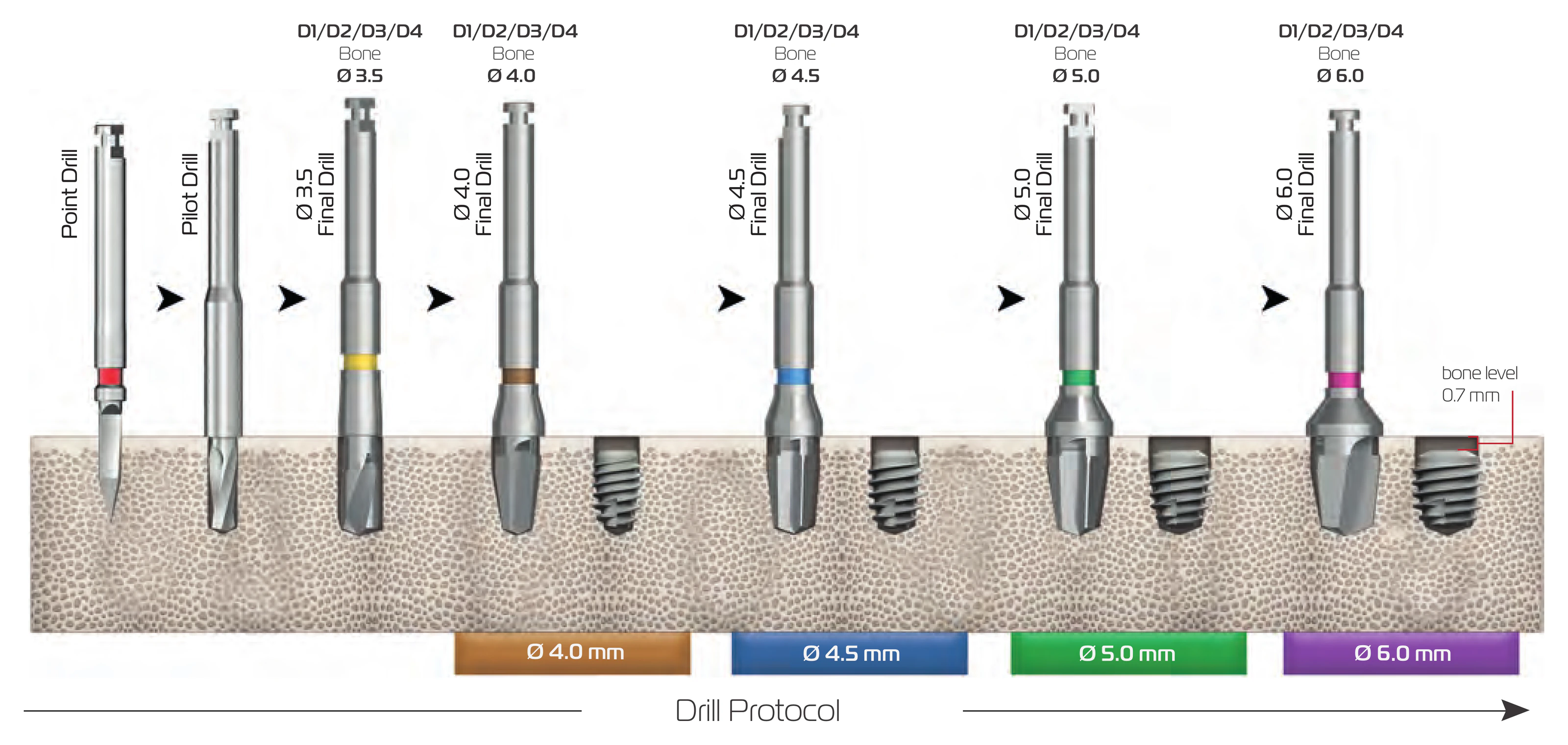 Drill protocol for 6.5 mm implants in D1/D2/D3/D4 bone: point drill, pilot drill and 6.5 mm final drills up to Ø 4.0, Ø 4.5, Ø 5.0 or Ø 6.0, with the implant 0.7 mm below bone level