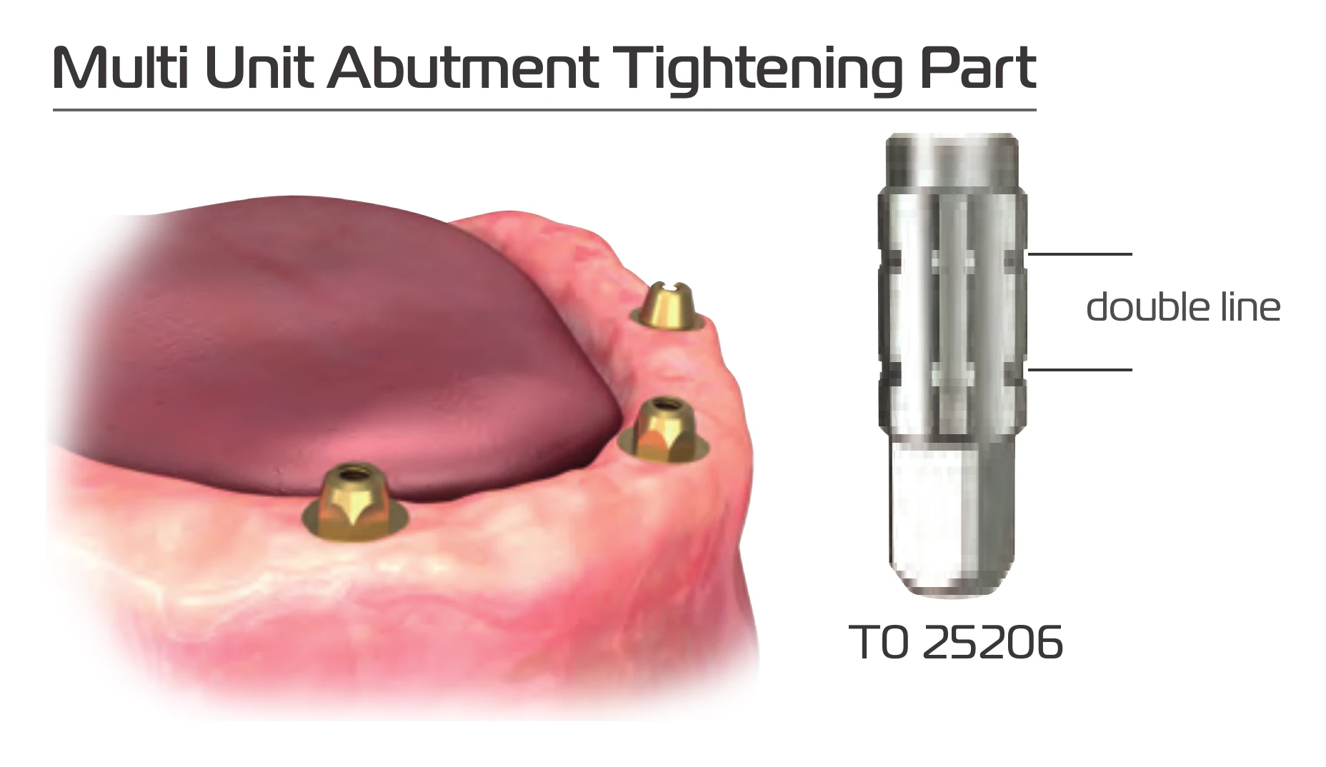 Multi-unit abutment tightening part T0 25206 with its double line marking