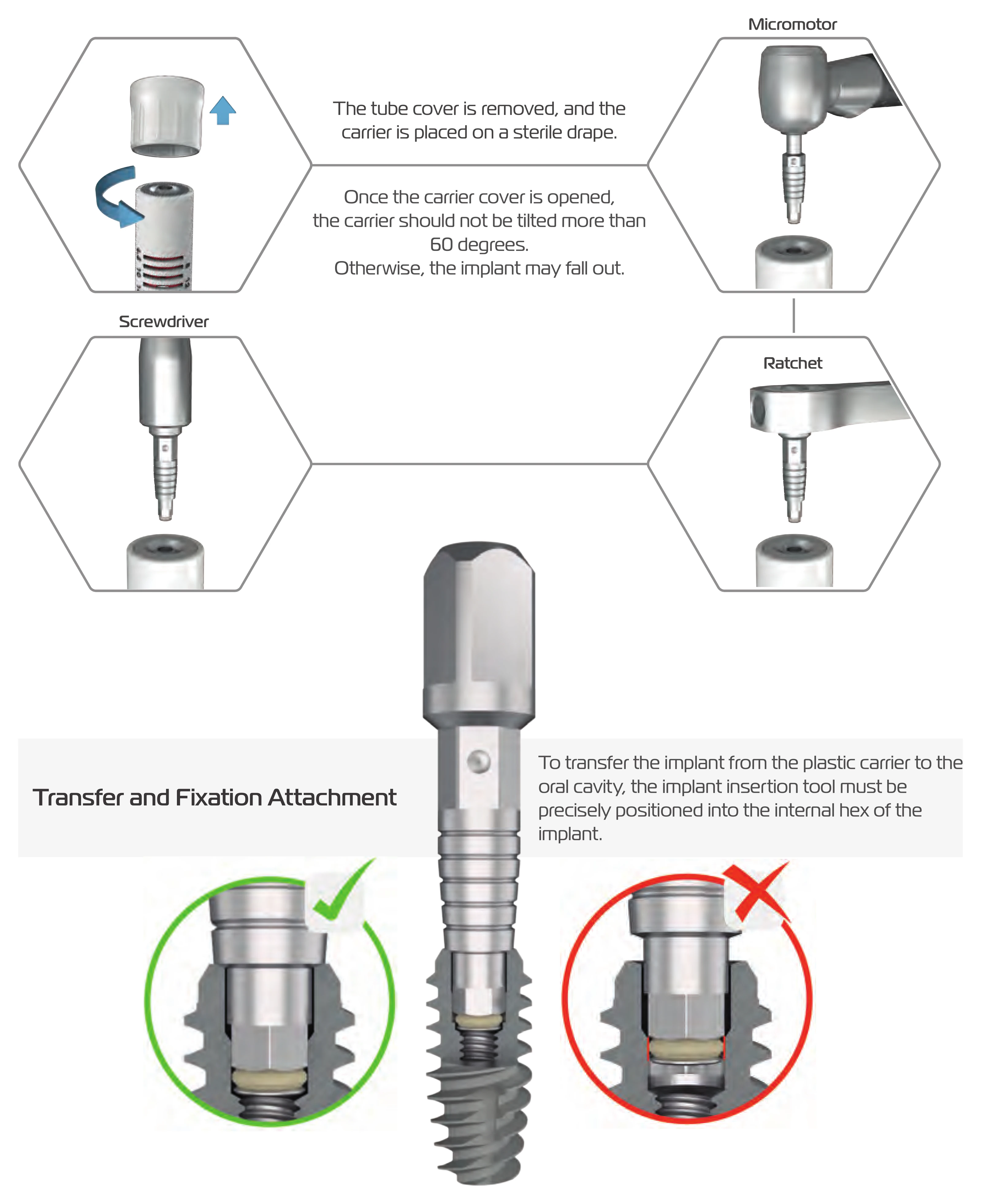 Steps for removing the tube cover and engaging the implant insertion tool with a micromotor, ratchet or screwdriver, with correct and incorrect seating of the tool in the implant hex